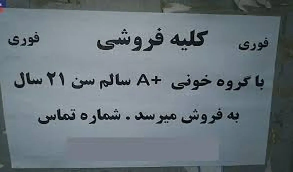 معاوضه کلیه با خودرو!
