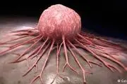 کاهش عوارض داروهای سرطان با روش جدید