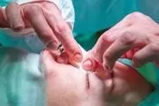 چه افرادی نباید بینی خود را عمل کنند؟
