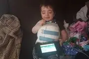 بیماری ژنتیکی نادر استخوان‌های این کودک را بیش از ۵۰۰ بار شکسته است