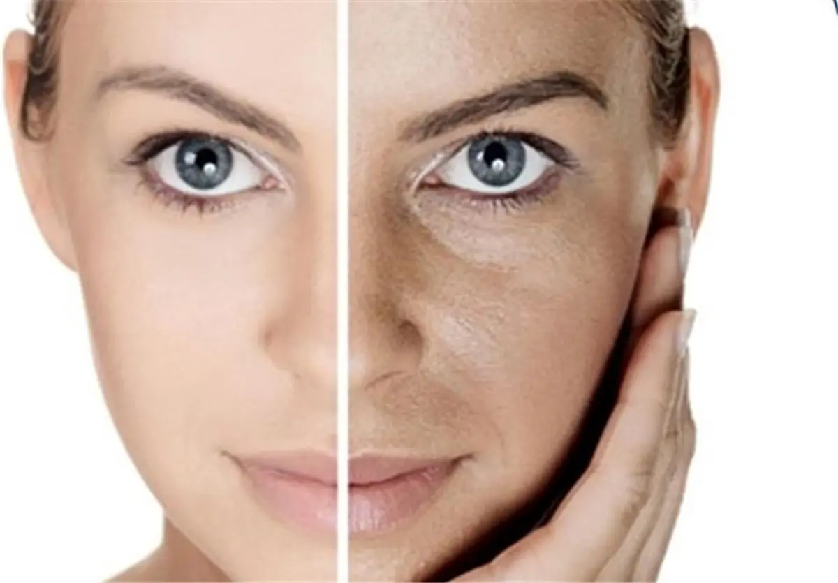 چگونه پوستی شفاف و بدون ترک داشته باشیم؟