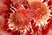 سلول‌های سرطانی کدام قسمت‌های بدن را دوست دارند؟
