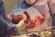هشدار وزارت بهداشت درباره سزارین‌های ۱۴۰۲/۰۲/۰۲