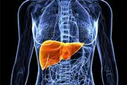 چه کنیم تا کبدچرب نگیریم؟