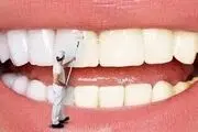 دندان‌های‌تان را در خانه سفید کنید/ ۵ روش طبیعی برای رفع زردی دندان
