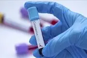 تولید اولین نمونه از کیت ایرانی تشخیص ویروس کرونا