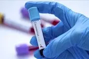تولید اولین نمونه از کیت ایرانی تشخیص ویروس کرونا