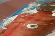 حرف های مدیر کل منابع طبیعی لرستان رشید را سوزاند نه آتش مراتع