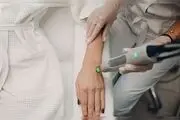 هرآنچه که باید درمورد لیزر موهای زائد بدانید
