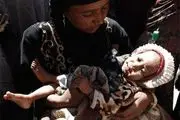 گزارش تصویری; فقر و گرسنگی در یمن