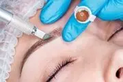 مایکروبلیدینگ چیست؟
