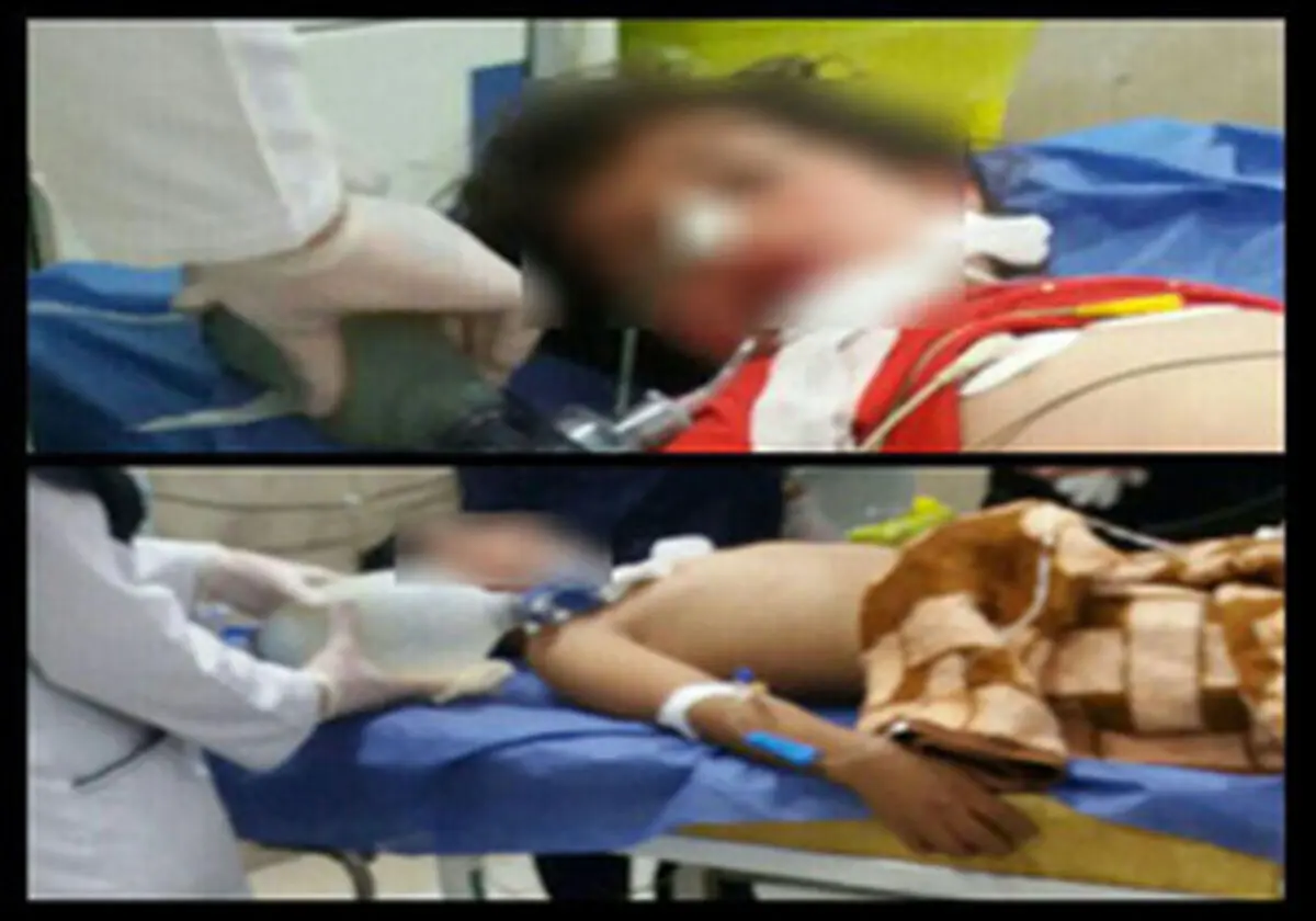 به کما رفتن دو کودک با یک اشتباه
