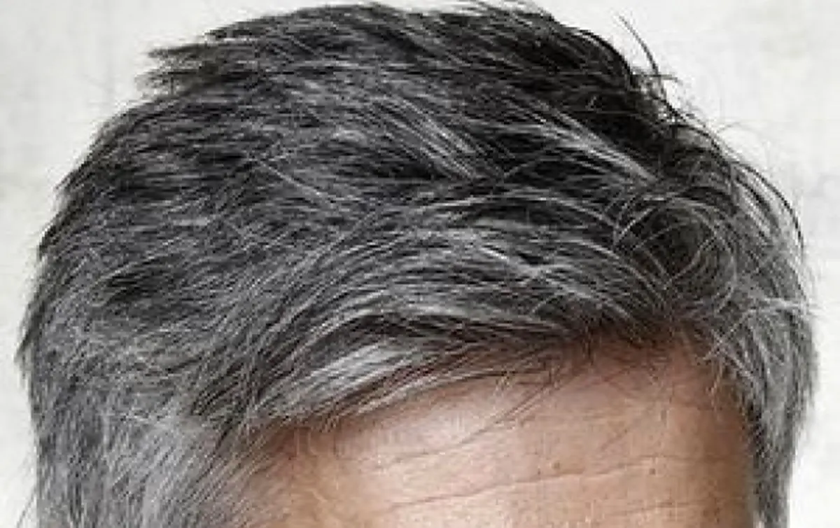 موهای سفید از وضعیت سلامتی ما چه میگویند؟
