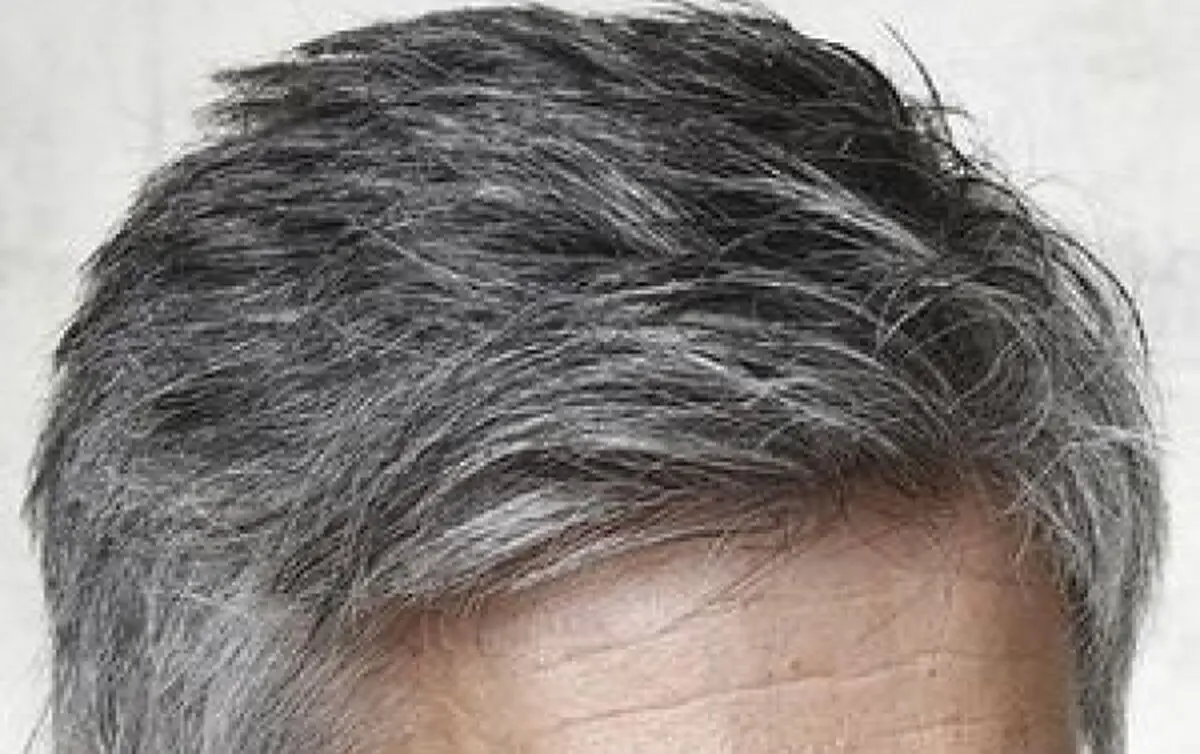 موهای سفید از وضعیت سلامتی‌ ما چه می‌گویند؟