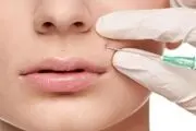 عوارض احتمالی تزریق ژل و فیلر در صورت 