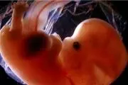 رواج فروش تخمک علیرغم داشتن عوارضی چون سرطان و مرگ