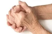 چه افرادی بیشتر در معرض بیماری ریوی قرار دارند؟