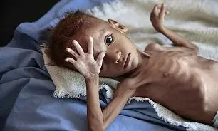هشدار سازمان ملل در مورد گرسنگی در یمن