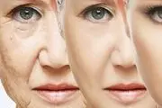 راهکارهایی برای جلوگیری از ایجاد چروک در پوست