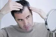 دمنوش‌هایی شگفت انگیز برای جلوگیری از ریزش مو