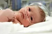 درمان بیماری کشنده ریه در نوزادان با کشف جدید دانشمندان
