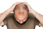 پک جدید گیاهی ضد ریزش مو با مجوز رسمی از نهادهای مربوطه در ایران تولید شد.