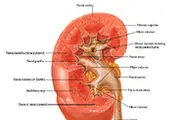 دیابت و پرفشاری خون ازعلل نارسایی مزمن کلیه
