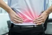 از دردهای سیاتیکی چه می دانید؟