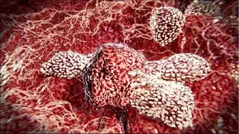 پروتئینی که ۱۰ هزار برابر بیشتر سلول‌های ضد سرطان تولید می‌کند
