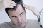 با این بیماری روانی «کچل» می‌شوید