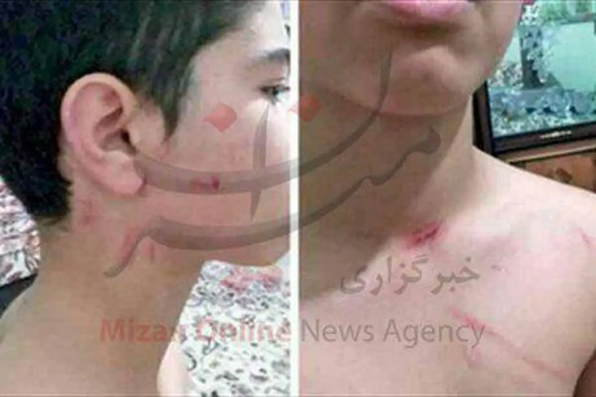 تعقیب قضایی معلمیکه دانشآموز را کتک زد