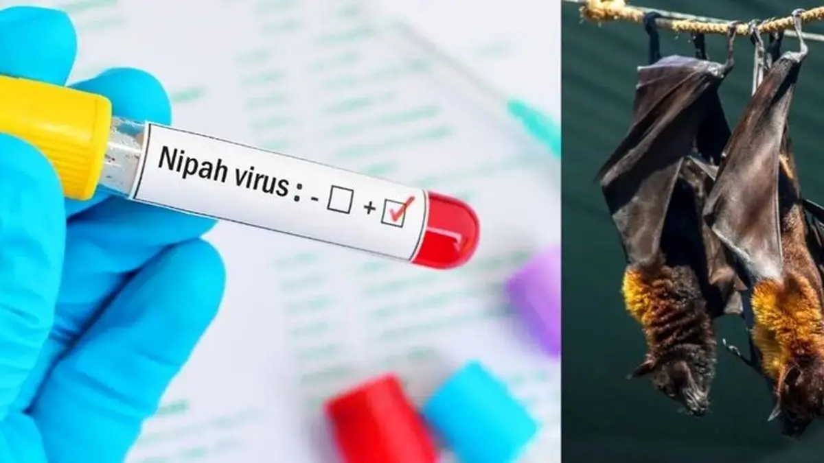 ویروس کشنده هندی نیپا چگونه است| علایم کشنده ویروس Nipah