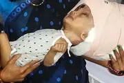 بزرگترین سر جهان مورد جراحی قرار گرفت