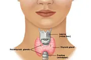 اختلال تیروئید با چشم ما چه می کند ؟