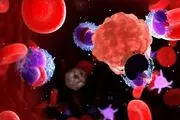 درمان جدید برای مقابله با سرطان خون کودکان
