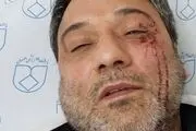 آمار تاسف برانگیز ضرب و شتم پرستاران در بیمارستان ها