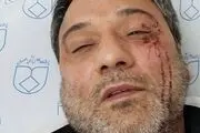 آمار تاسف برانگیز ضرب و شتم پرستاران در بیمارستان ها