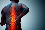 راه های پیشگیری از پوکی استخوان/ اینفوگرافی