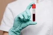 گروه خونی طلایی کشف شده در ایران چه ویژگی دارد؟