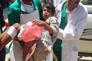 حملات هوایی جنگنده های سعودی به استان «إب» یمن