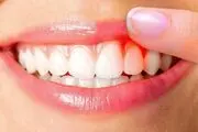 دیابتی‌ها و مشکلات لثه