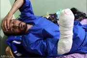 طالبان اینگونه دست‌و‌پا قطع می‌کنند + عکس