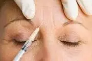 چند هشدار درباره تزریق ژل یا چربی به صورت
