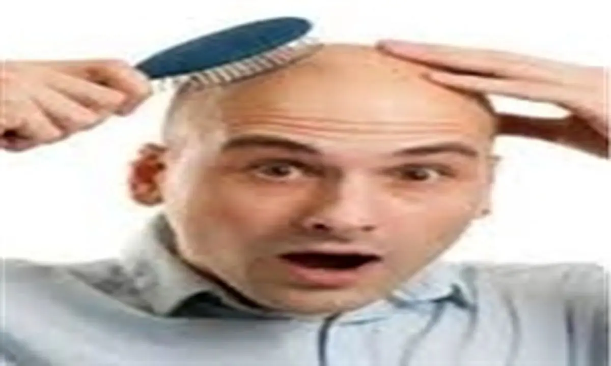علل ریزش موی سکهای