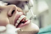 لمینت سرامیکی بهتر است یا کامپوزیت؟


