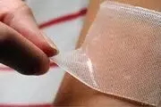 زخم‌های مزمن؛ یک اپیدمی بی‌سر و صدا / معضل «زخم بستر» در بیماران بستری
