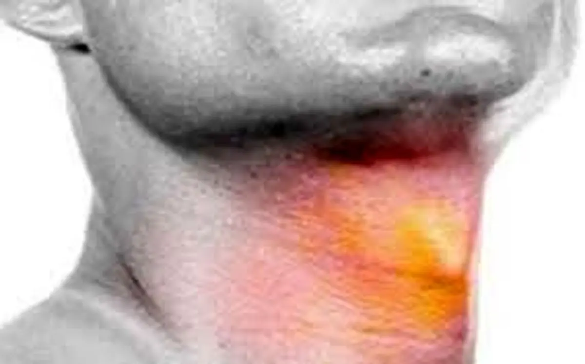 تغییر و گرفتگی صدا را جدی بگیرد