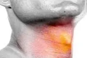 تغییر و گرفتگی صدا را جدی بگیرد