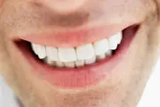 6 توصیه غذایی برای زیباسازی خنده شما
