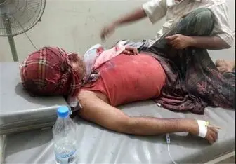 حمله عربستان به غرب یمن به ۱۲۰ شهید برجای گذاشت